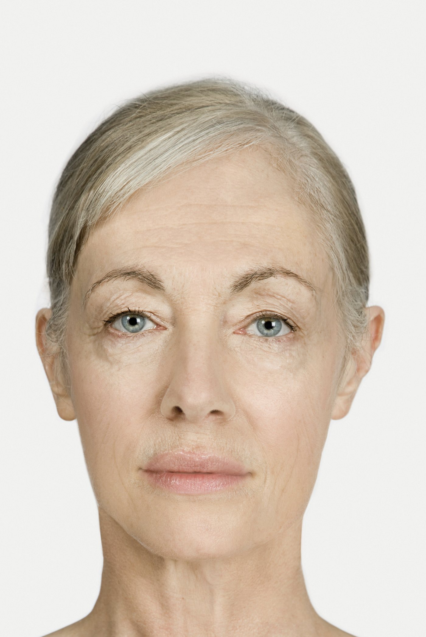 After treatment