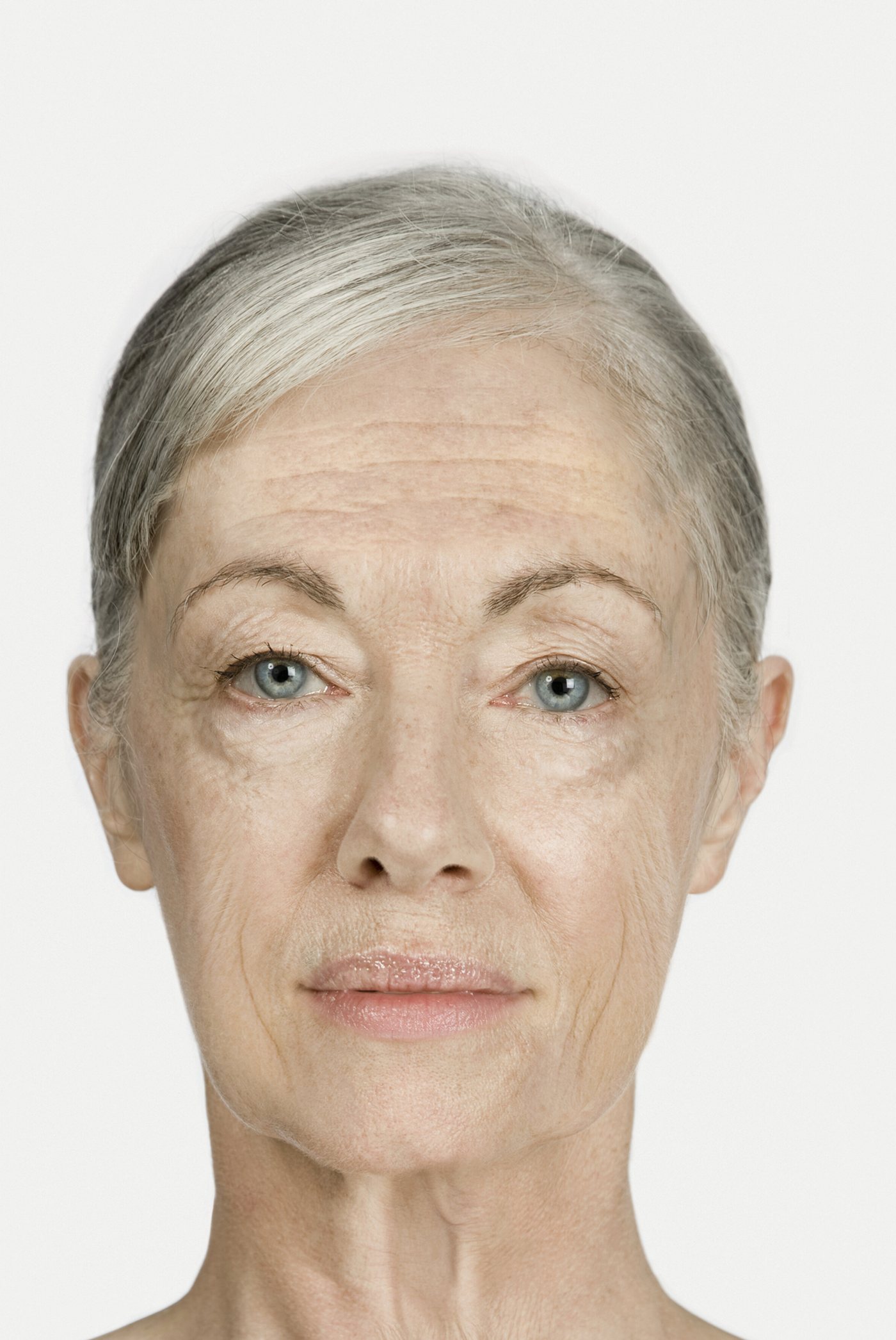 Before treatment